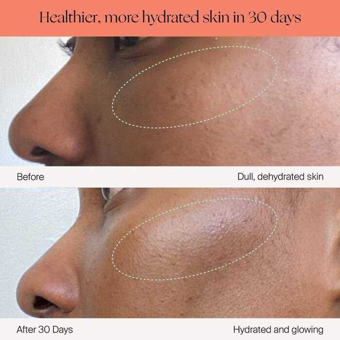 Canopy Humidifier for Skin Hydration - Image 5